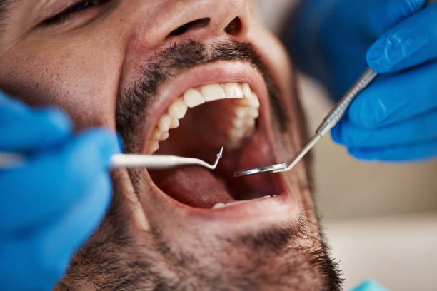 Best Emergency Dental Care for Broken or Chipped Teeth in Stayton, OR